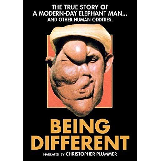 BEING DIFFERENT (1981)
