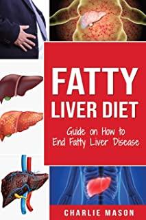 Fatty Liver Diet: Guide on How to End Fatty Liver Disease Fatty Liver Diet Books: Fatty Liver Diet (fatty liver diet for fatty liver Boo