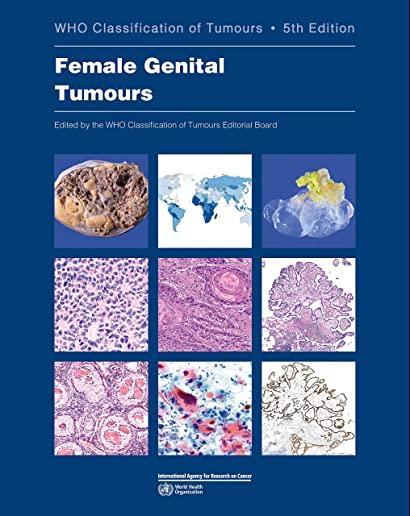 Female Genital Tumours: Who Classification of Tumours