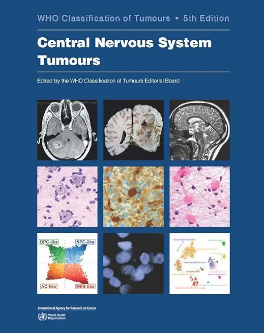 Central Nervous System Tumours: Who Classification of Tumours