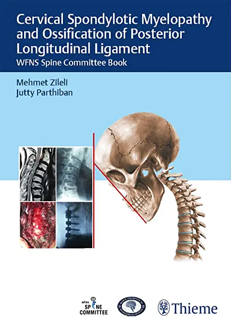 Cervical Spondylotic Myelopathy and Ossification of Posterior Longitudinal Ligament: Wfns Spine Committee Book
